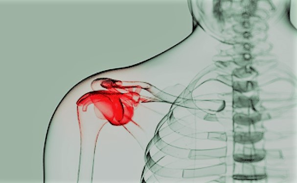 anatomía del hombro con resaltado en rojo en la capsula articular