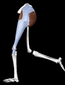 Síndrome cintilla iliotibial