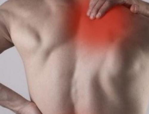 Contracturas musculares: qué son y cómo ayuda la fisioterapia