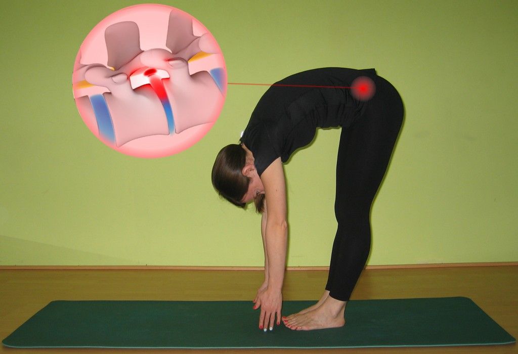 DOLOR LUMBAR AL AGACHARSE